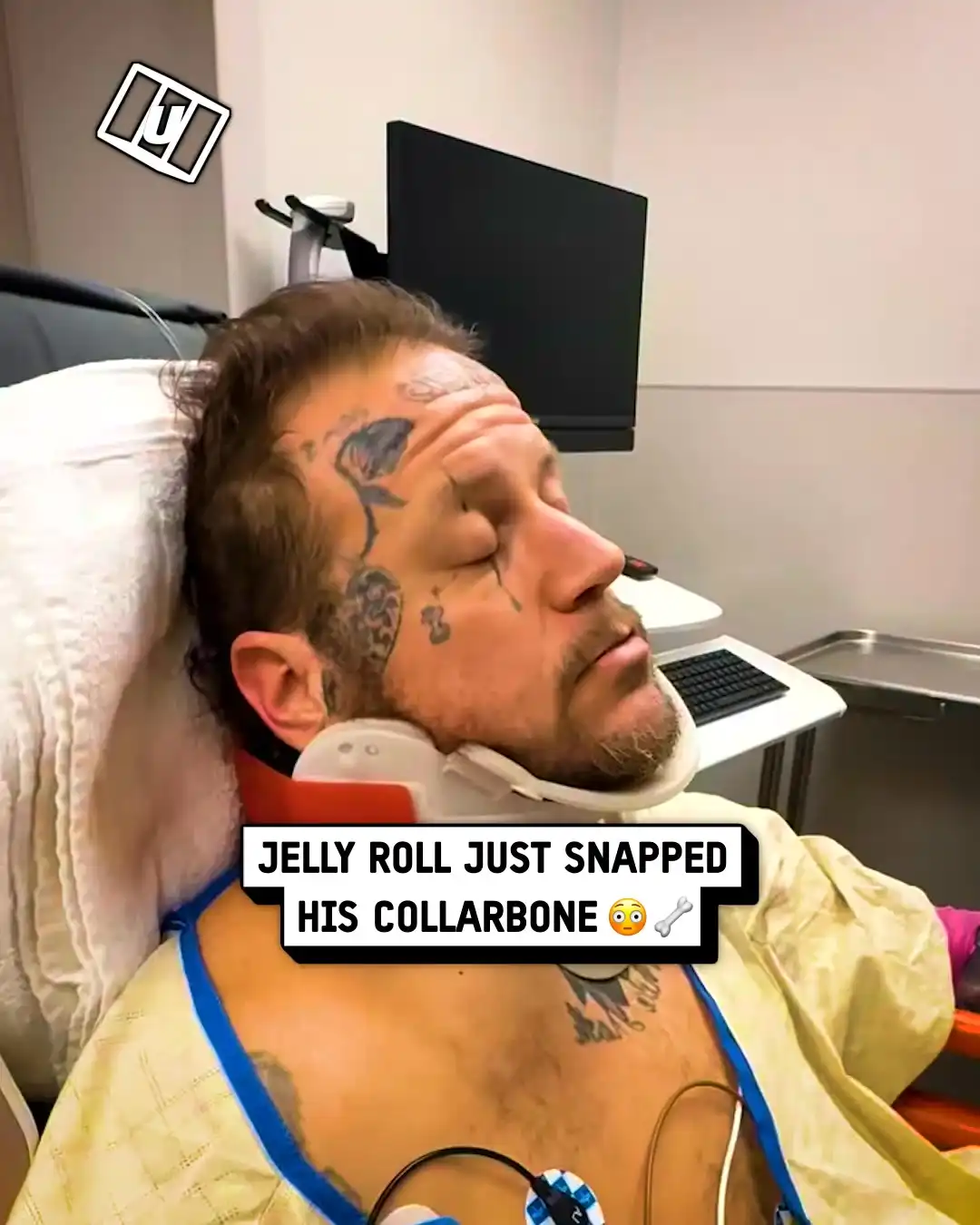 Jelly Roll snaps his collarbone 😳