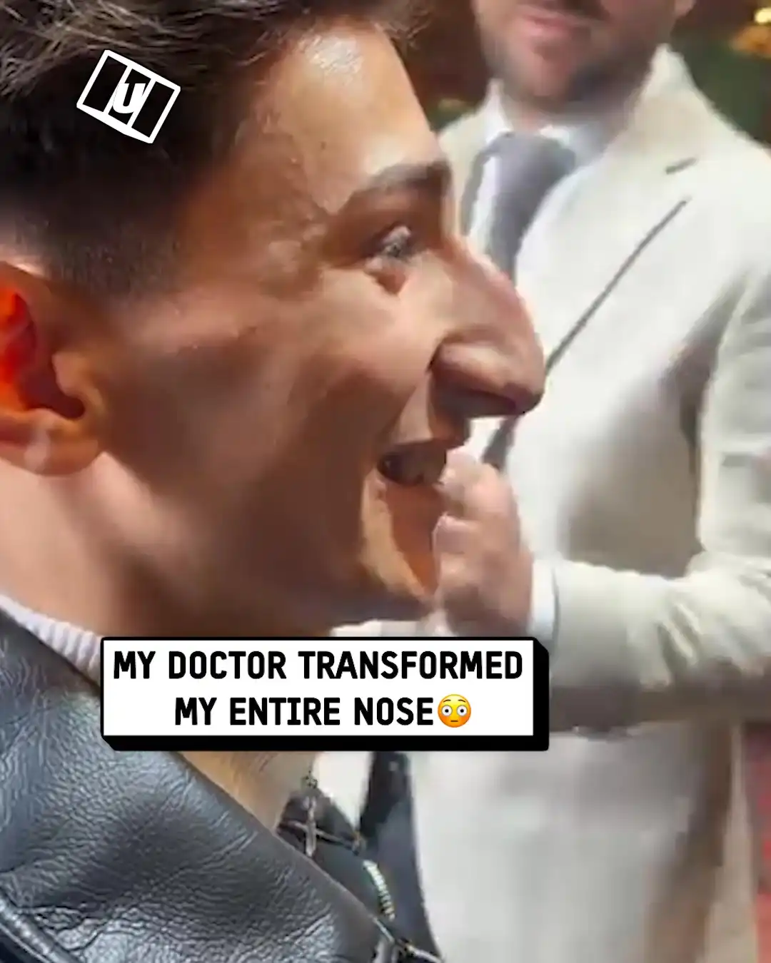 Guy's amazing nose job transformation