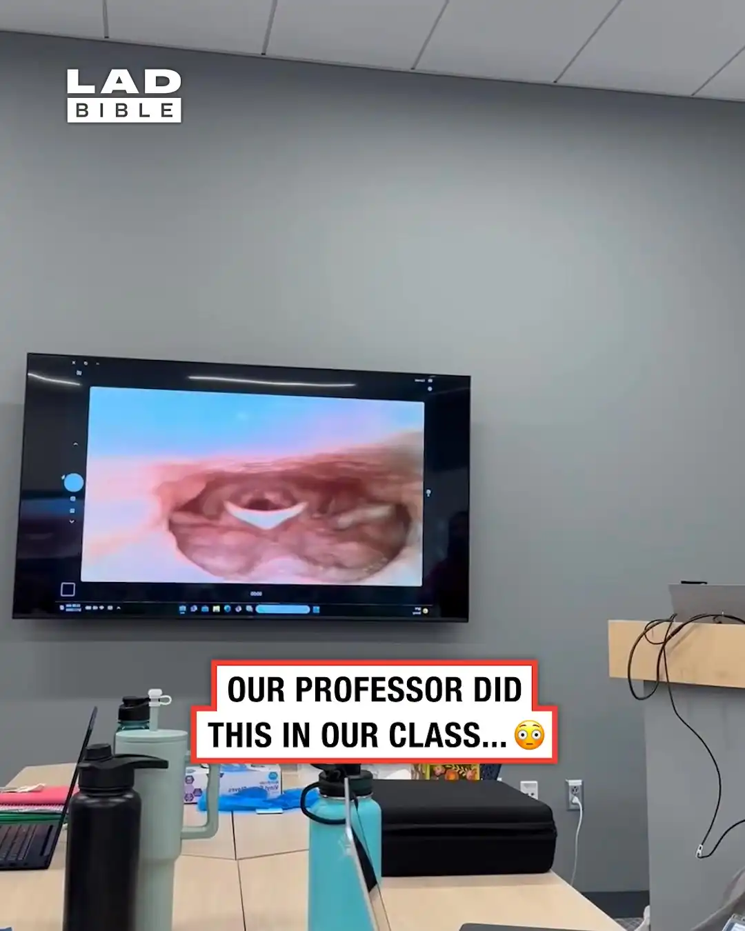 Our Professor Put a Camera Down Her Throat πΈ
