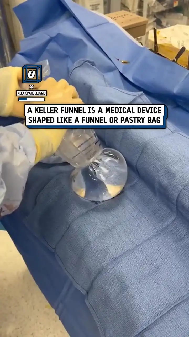 How implants are inserted 🍒🤯