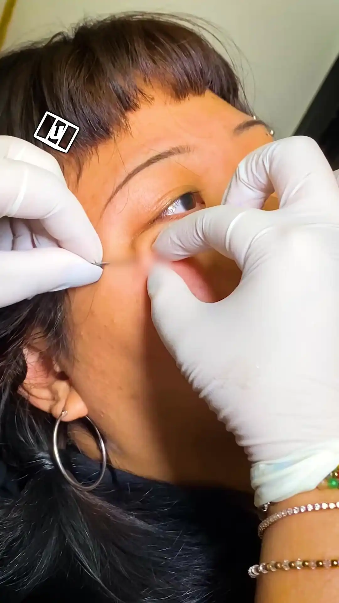 Dermal piercing on my face 🫣