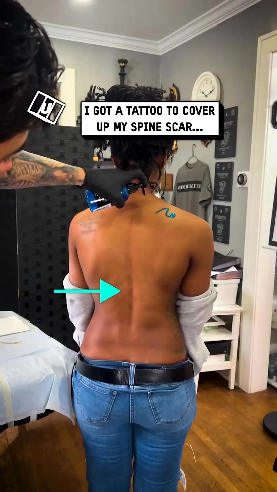 Covering my scar with a giant tattoo