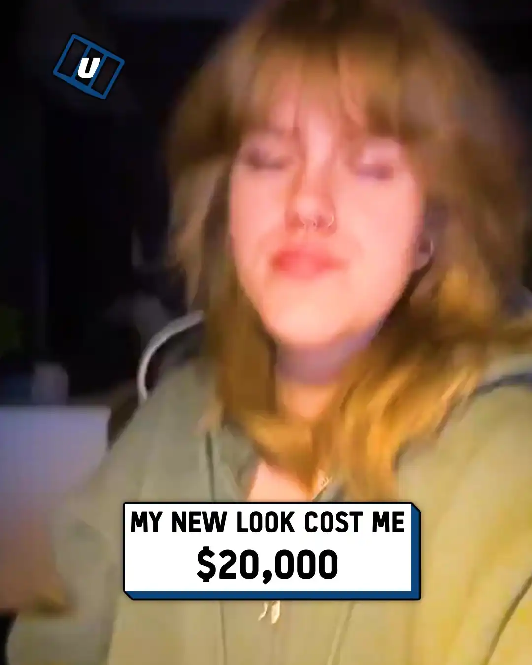 Doctors had to break my jaw 😬🤯