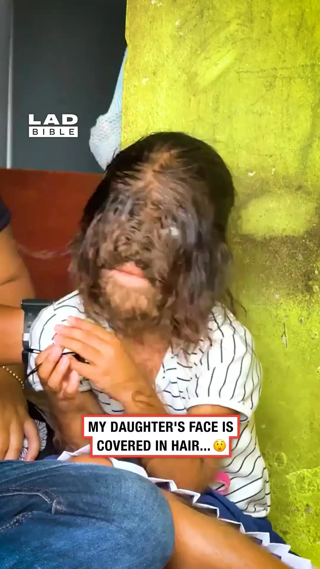 My daughter has hair growing out of her face 😮