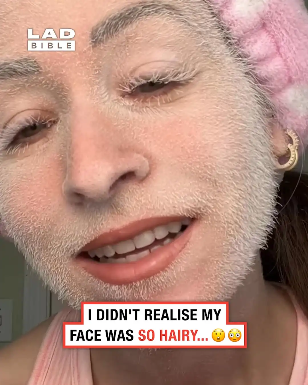 Had no clue my face was so hairy 🫣😳