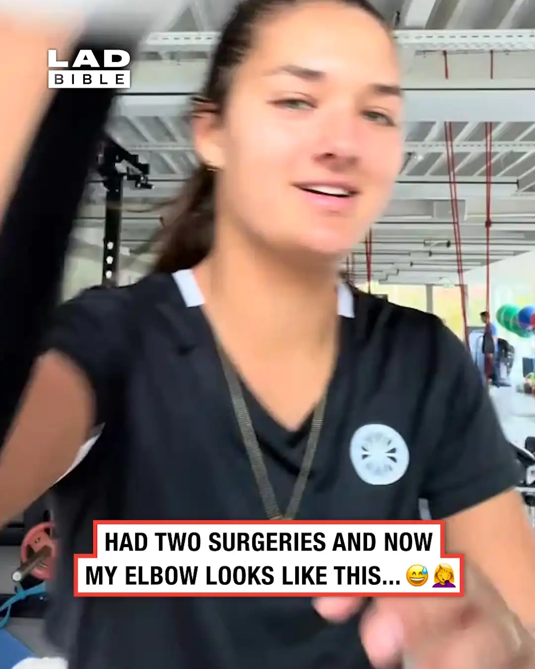 My new elbow looks suspicious 🤨