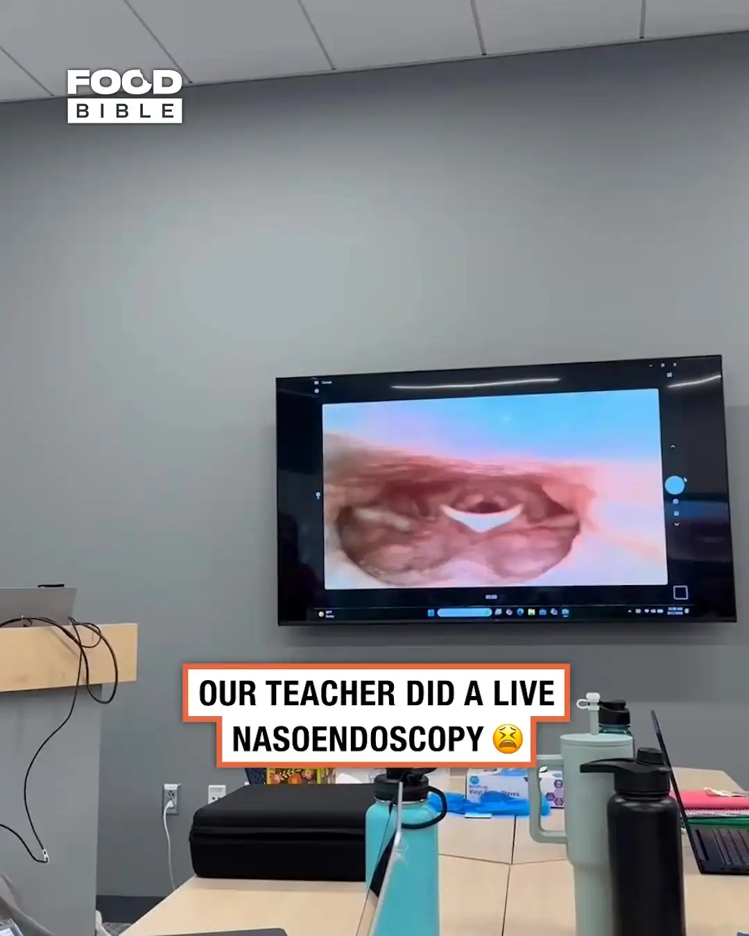 Our professor put a camera down her throat 😯