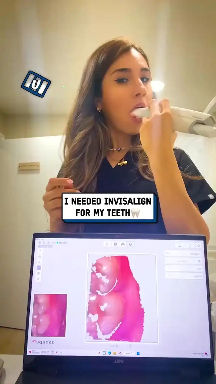 Doing my own Invisalign scan π¦·π€―