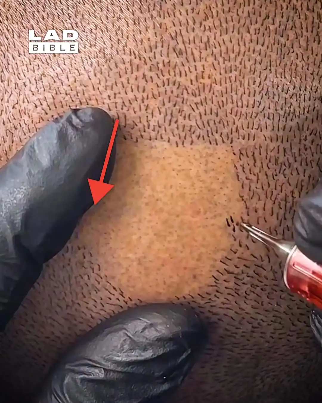 Getting my hair tattooed 😲