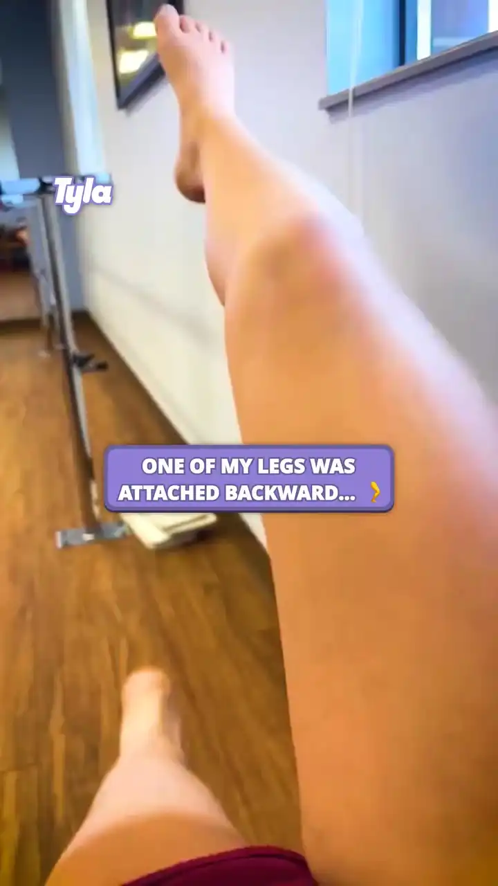 One of her legs is backwards?! 😲 #fblifestyle