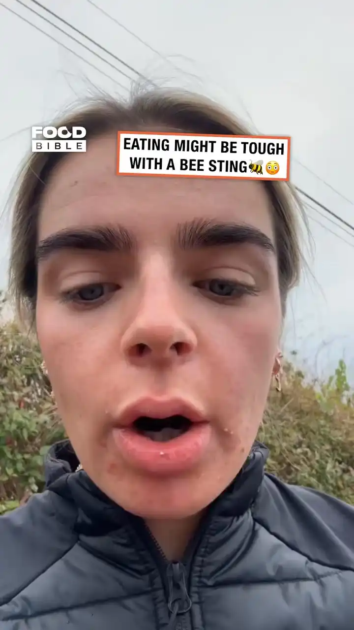Woman reacts to bee sting 🐝