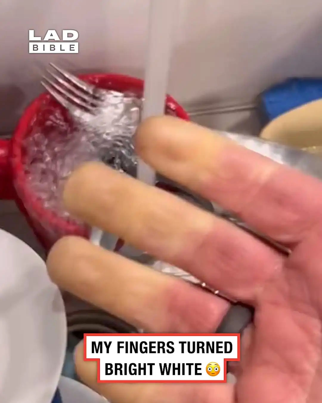 My fingers turned bright white 😳