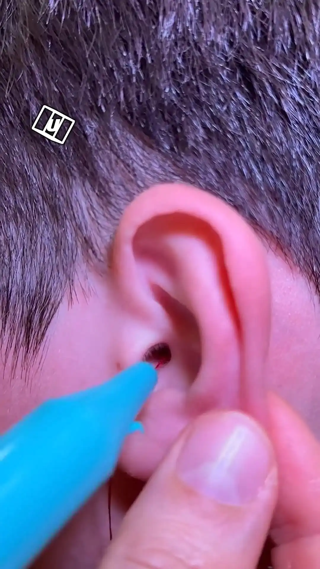 My ear plug feels like jelly 🫠