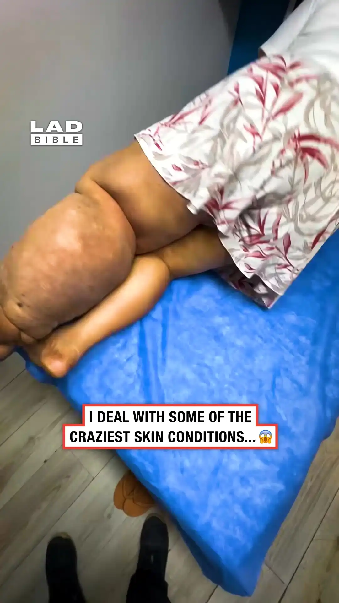 Lymphologist deals with the craziest things 🤯