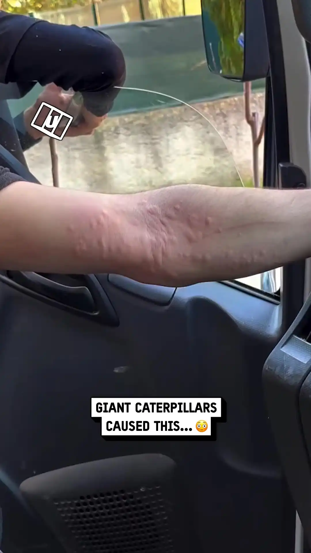 I got bitten by caterpillars 💀