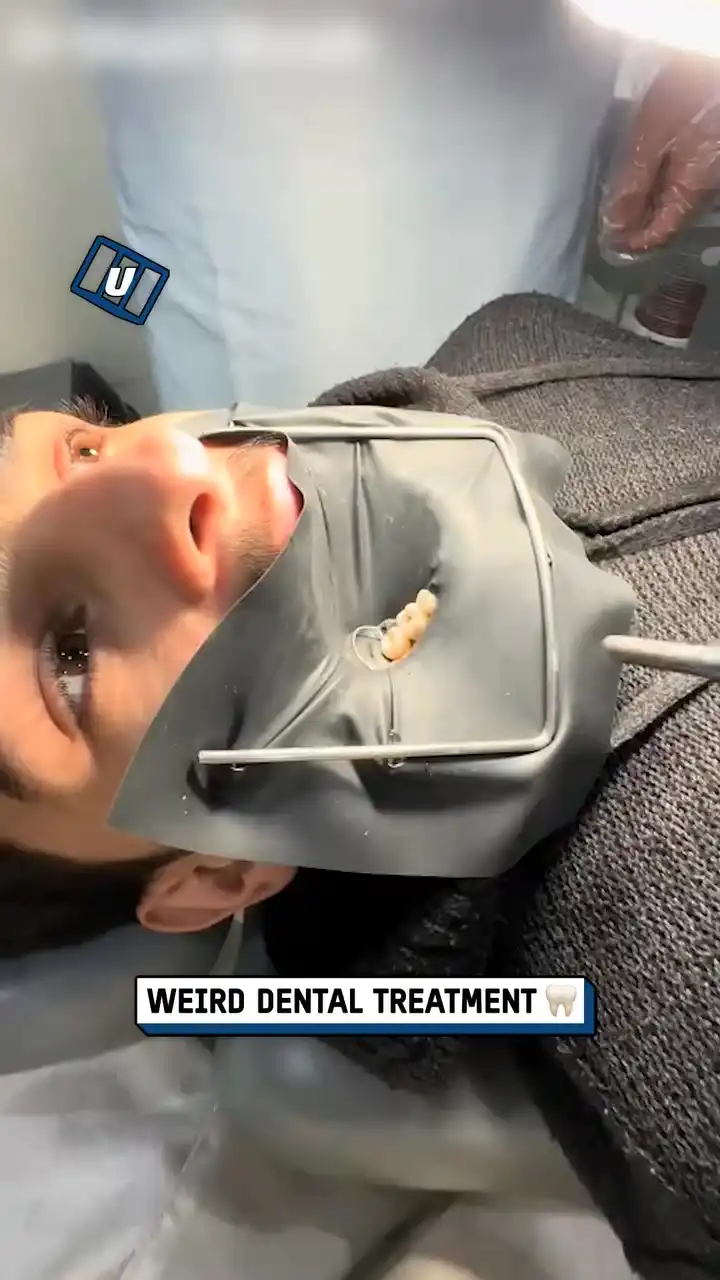 Weird dental treatment 🦷