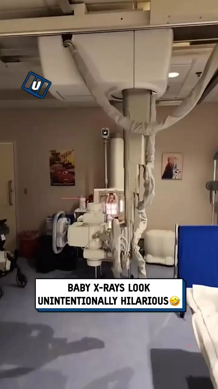 How babies get X-rays ๐ถ๐คฃ