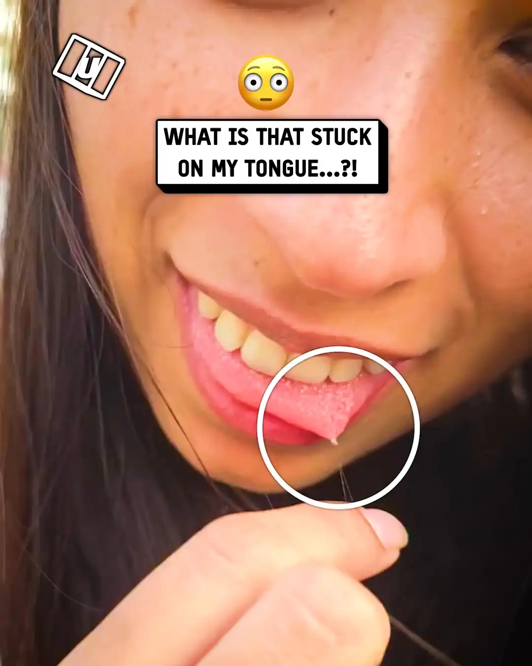 What is this stuck on my tongue?! 😵👅