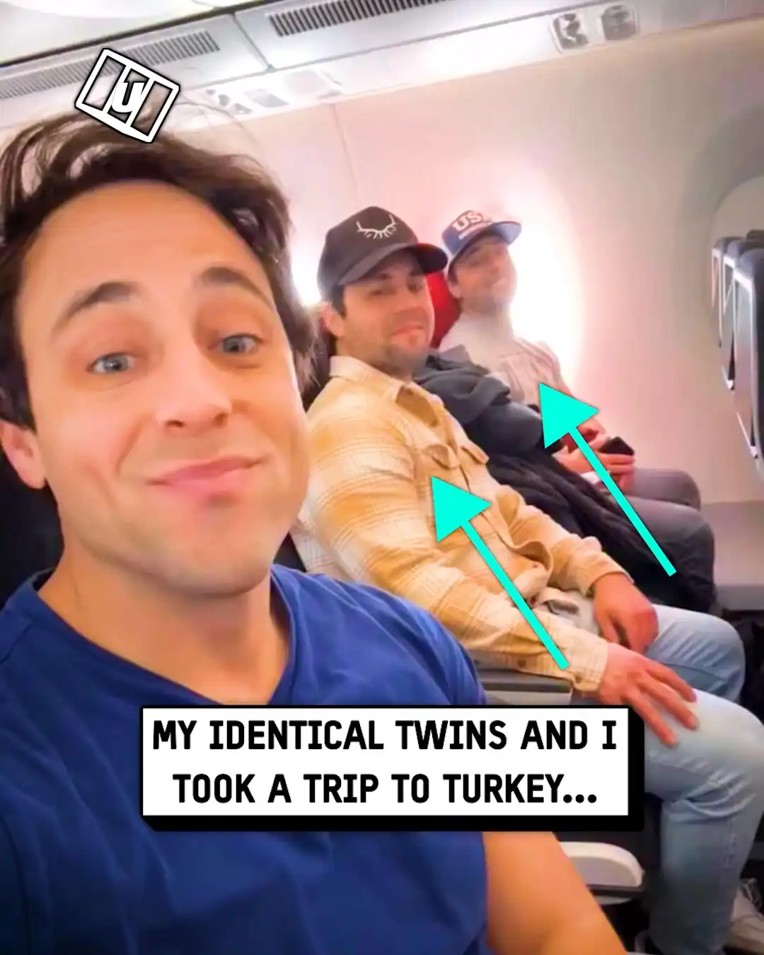 Identical triplets get hair transplants together 😅