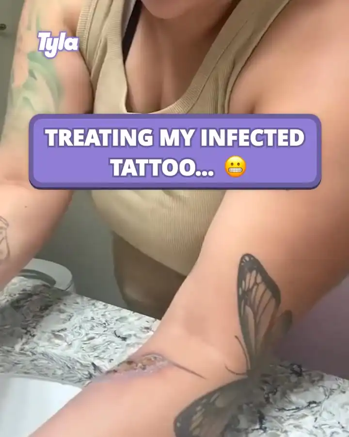 I'm no doctor but that certainly looks infected 😅 #fblifestyle