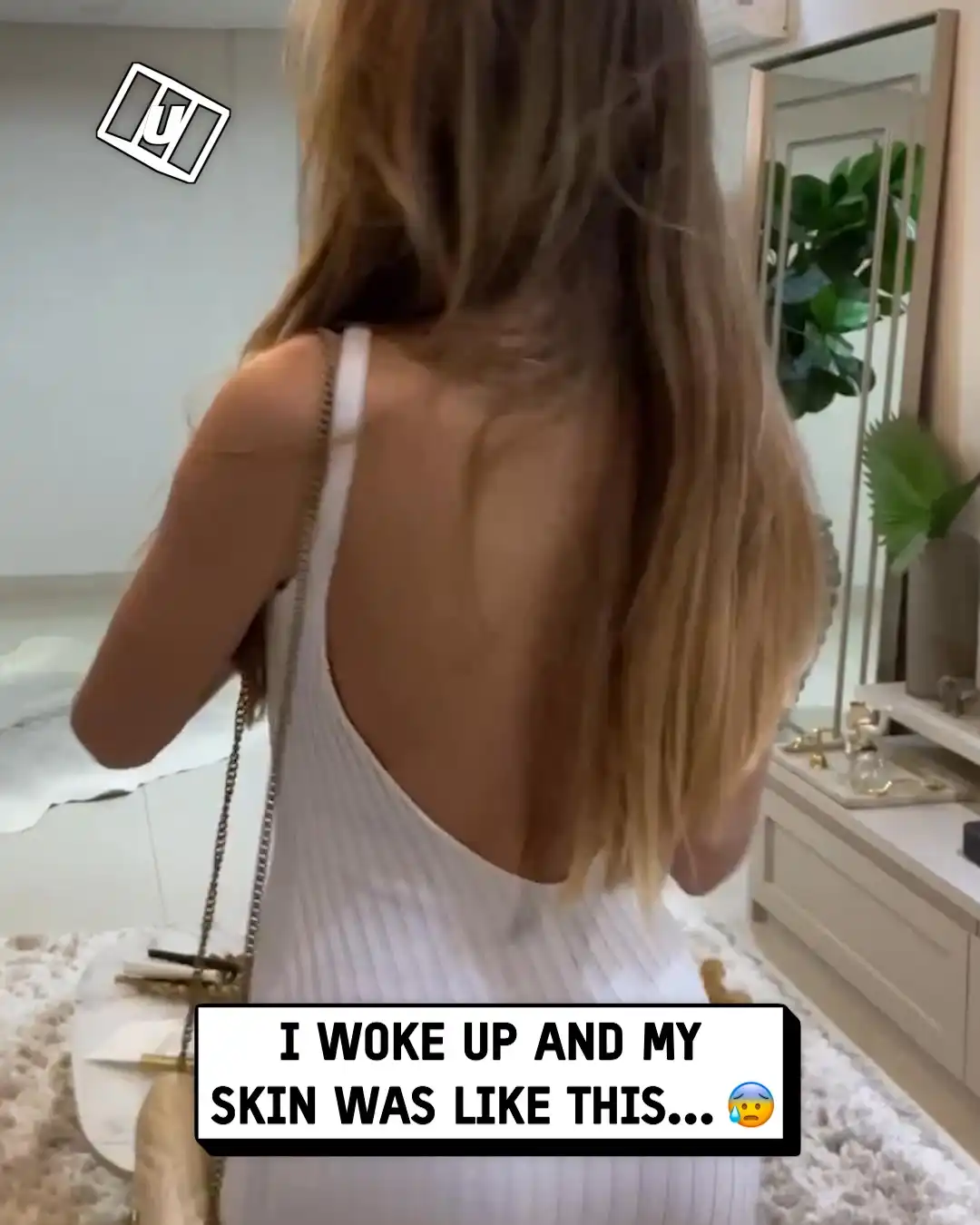 What's happening with my skin 😳