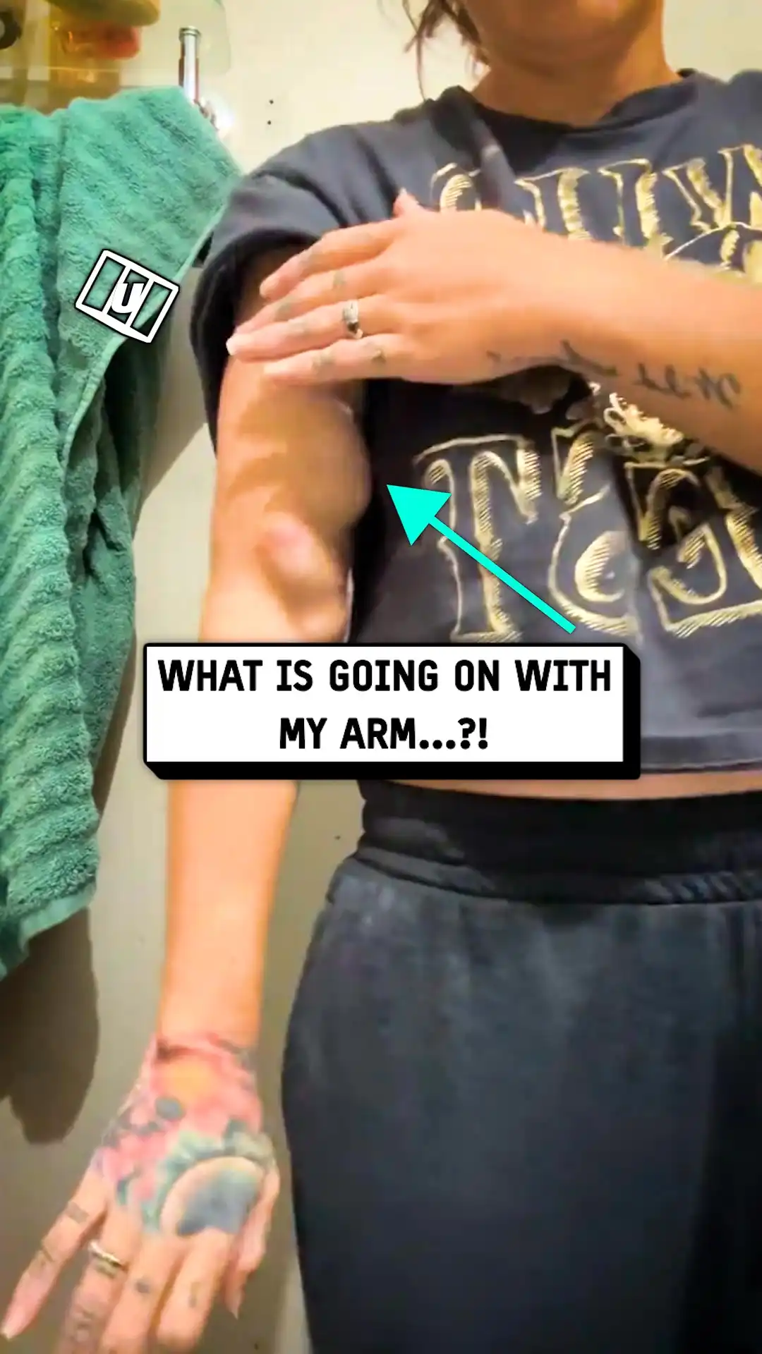 My arm is acting up π³