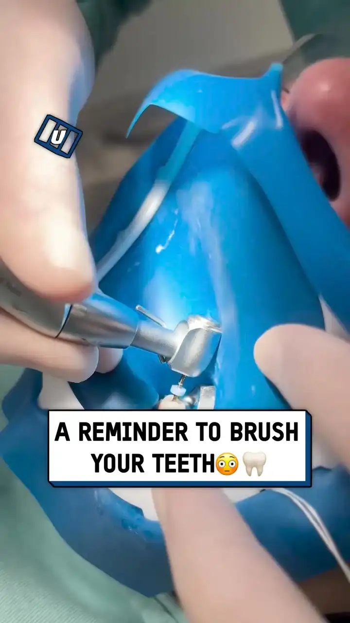 BRB off to brush my teeth 🏃😬#fblifestyle