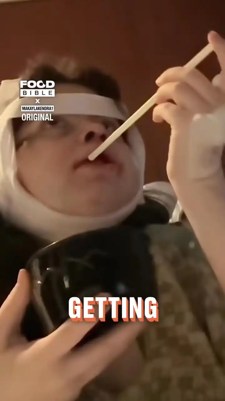 Double Jaw Surgery Journey 😯