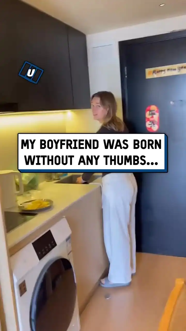 Having no thumbs comes with some benefits 😲👍 #fblifestyle