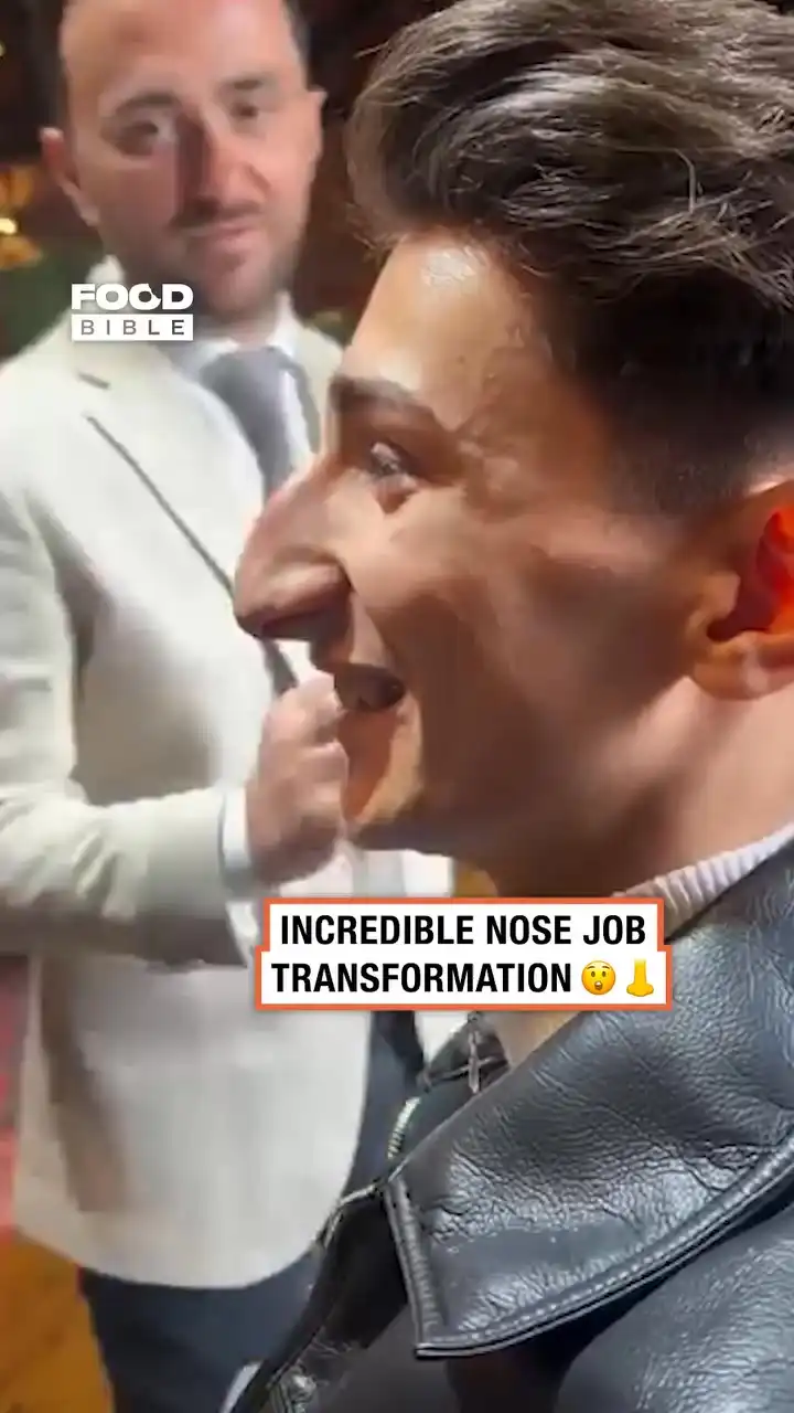 Nose job completely changed his face 😯