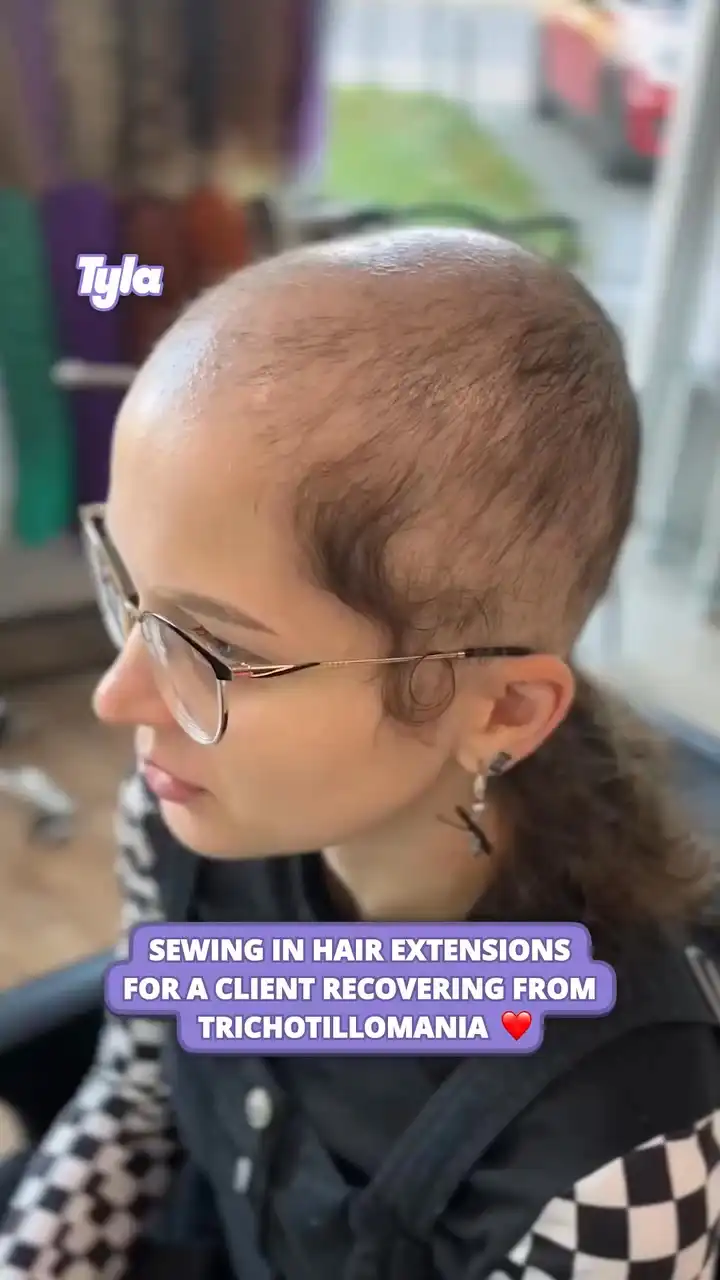 Sewing in hair extensions for a client recovering from trichotillomania ❤️