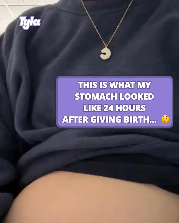 Woman shows how her stomach looks just after giving birth