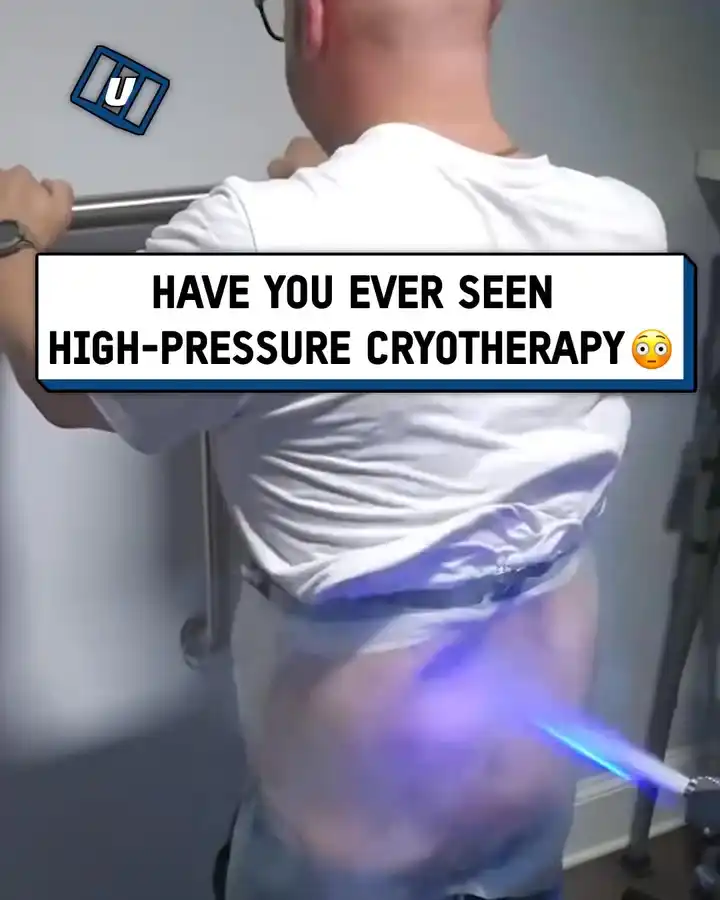 High pressure cryotherapy 🥶🤯