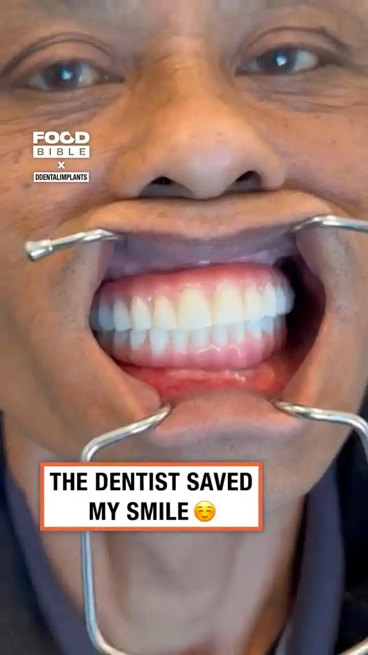 Digital Dental Implants 🦷