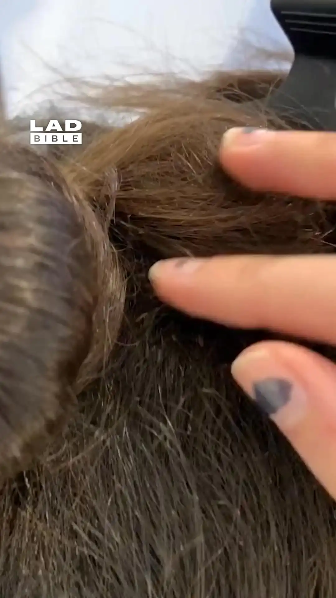 My client's hair was full of lice 😱