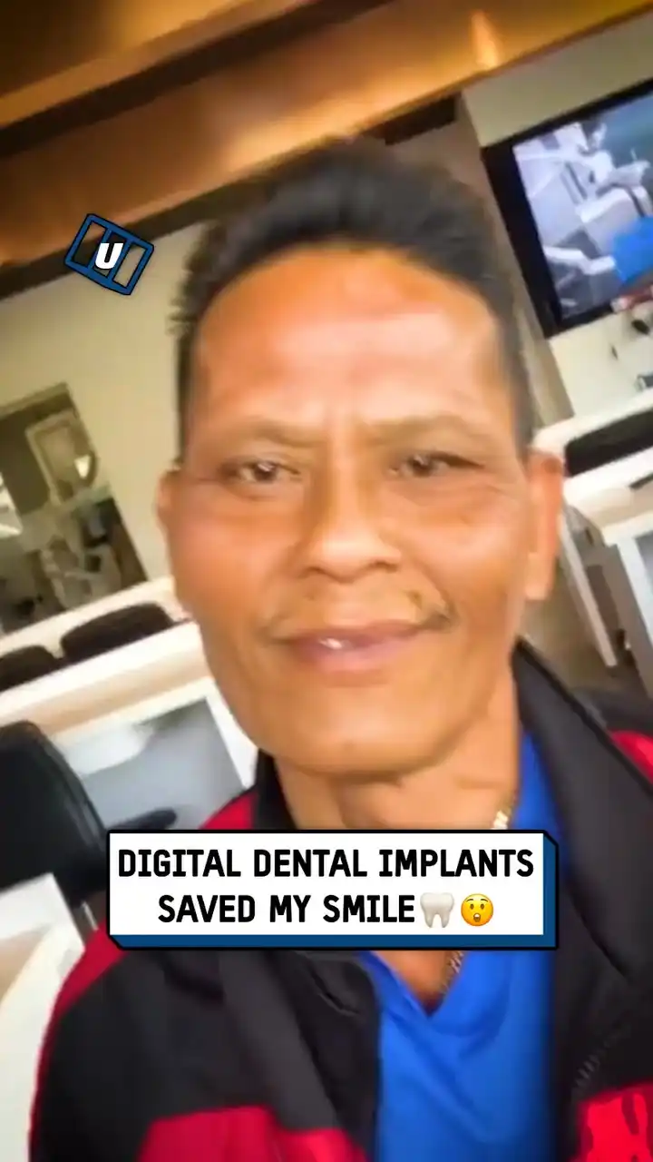 Digital dental implants 🦷😲
