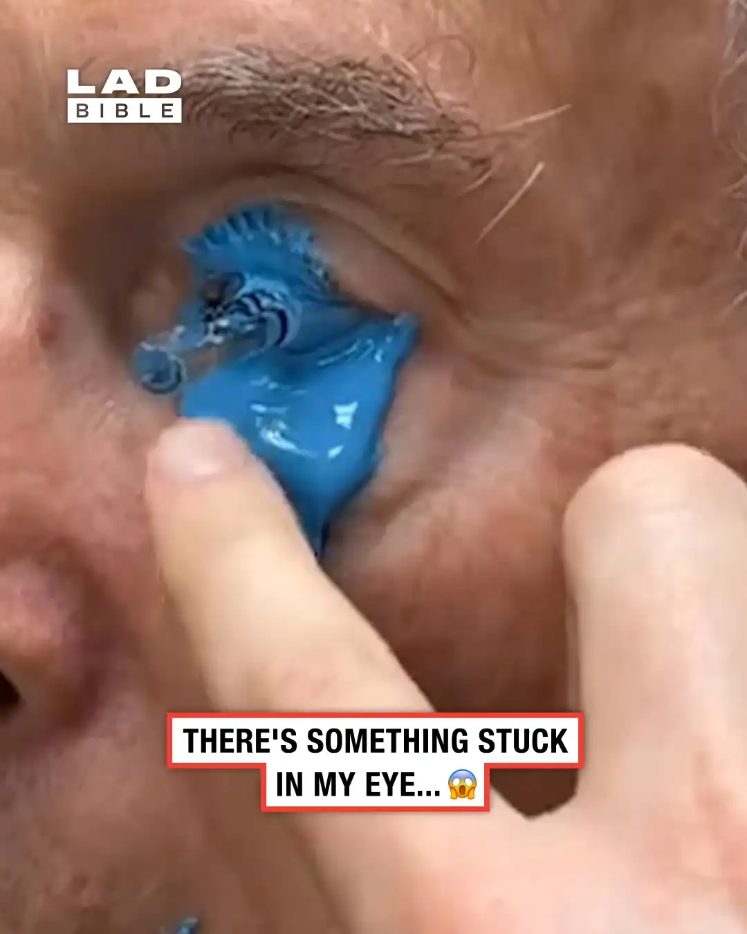 Getting a mould of my eye 👀