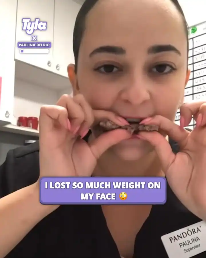 I lost so much weight on my face 😳