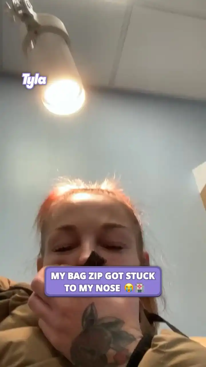 My bag zip got stuck to my nose 😩