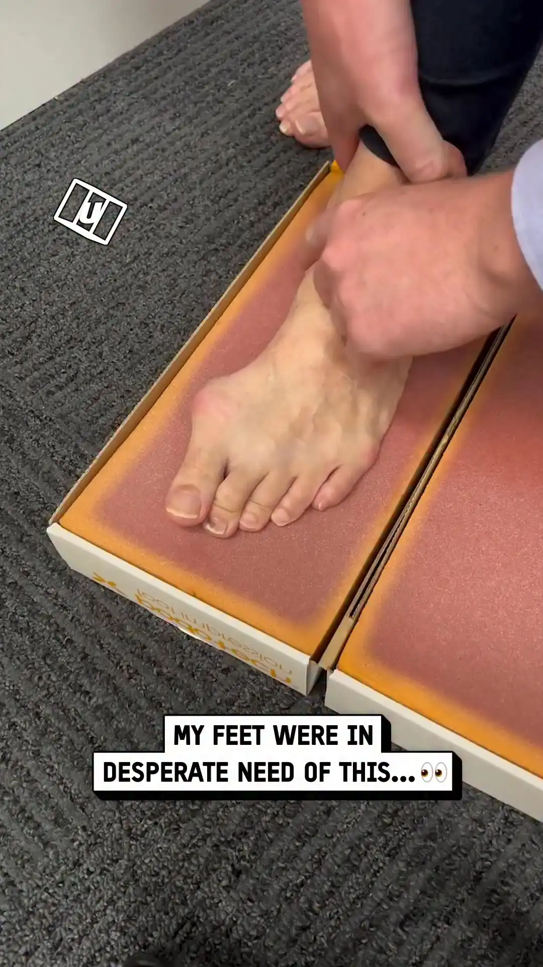 Getting custom feet orthotics 😲🦶