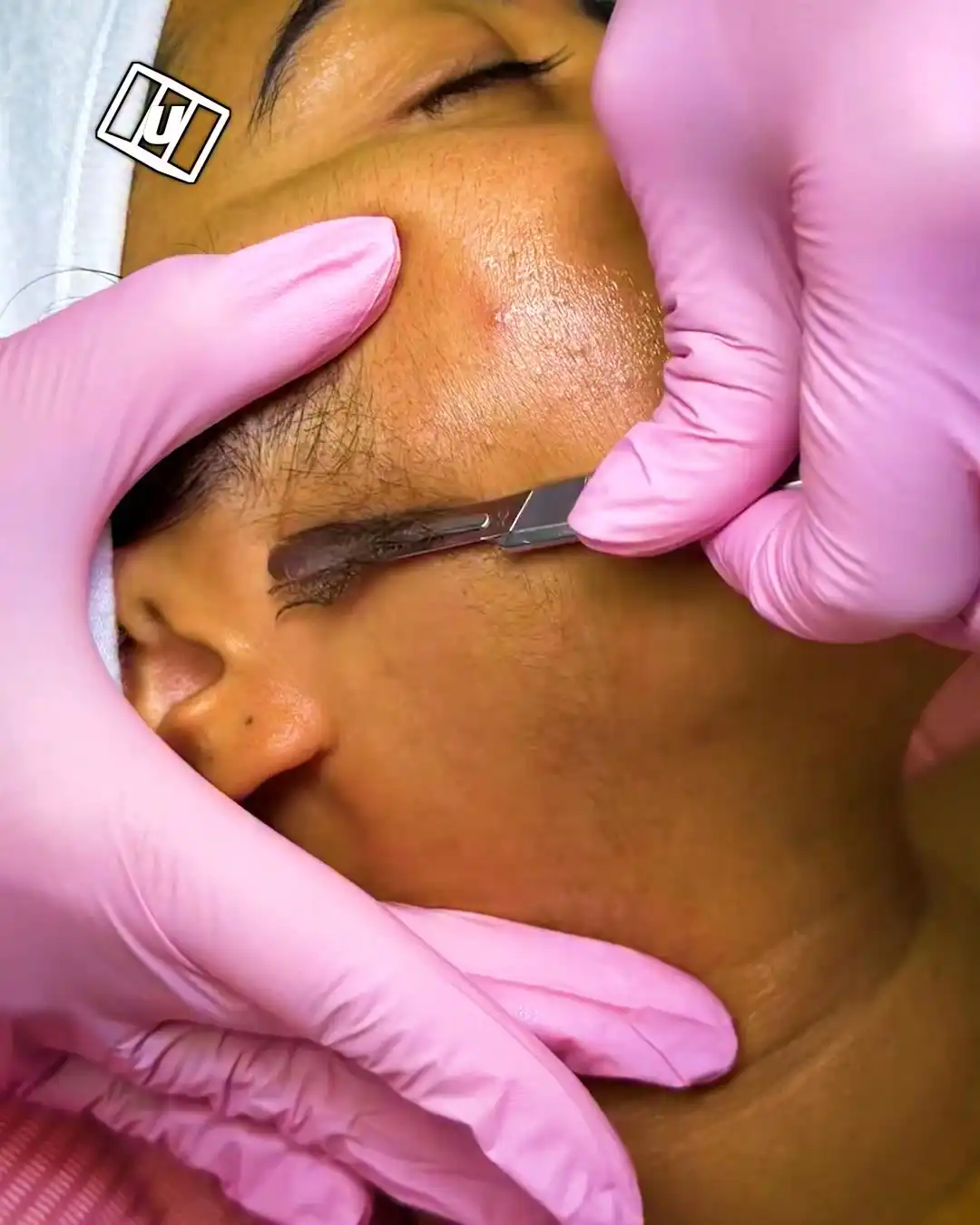 Dermaplaning my client's face 😮💨🧖♀️