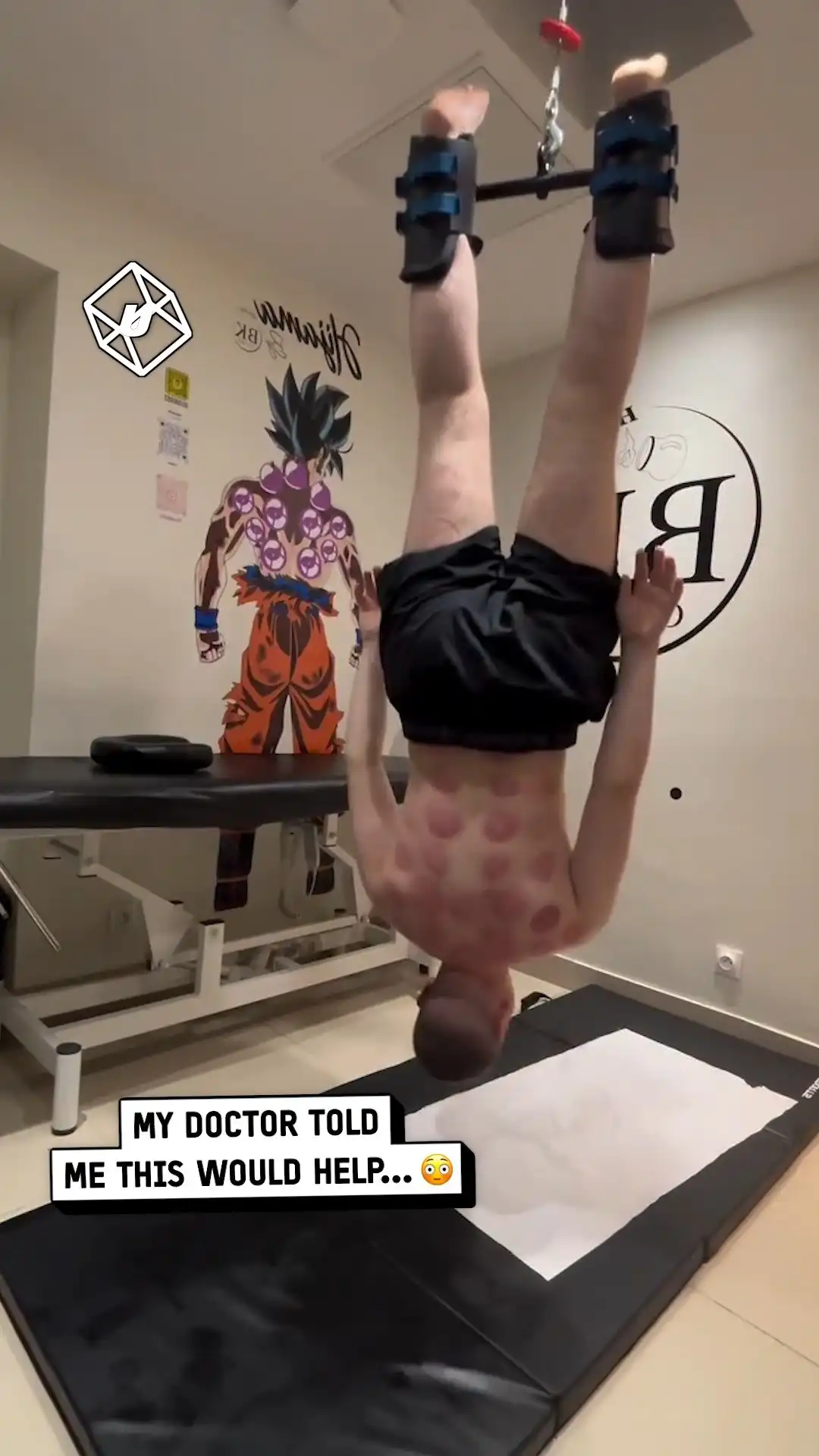 They told me this would help my back π