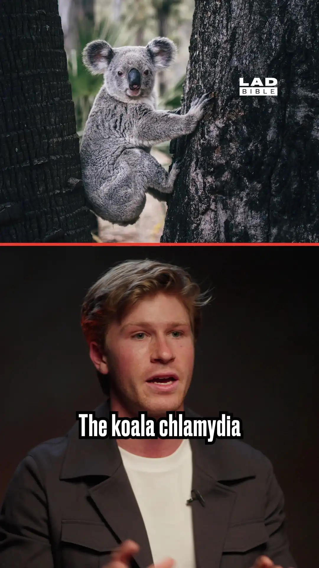 Robert Irwin on koalas having chlamydia