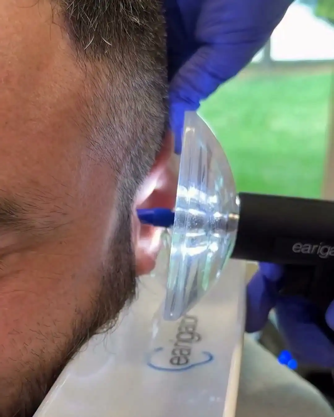 I could feel something in my ear 👂 #ears #interesting #didyouknow #crazy
Credit: @dr._earwax on Instagram 📹