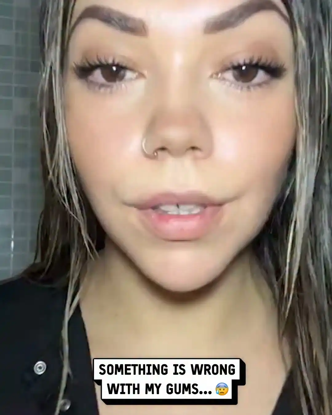 My gums started looking like this 😳 #mouth #health #shocking
Credit: @anitahfernnadez14 on TikTok 📹