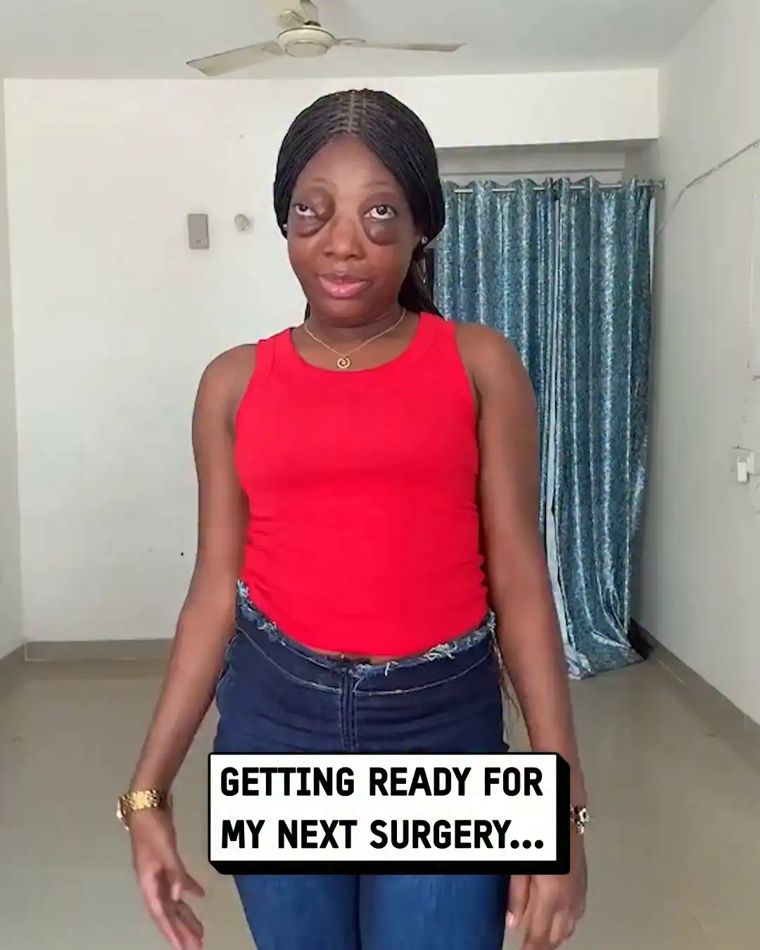 I have had to overcome so much 😭 #health #eyes #didyouknow
Credit: @‌suzylifestyle30 on TikTok 📹