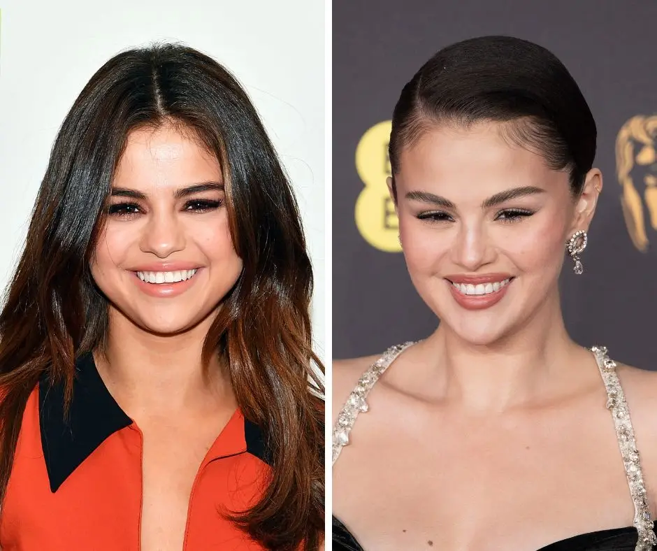 Selena Gomez 2017 vs 2025