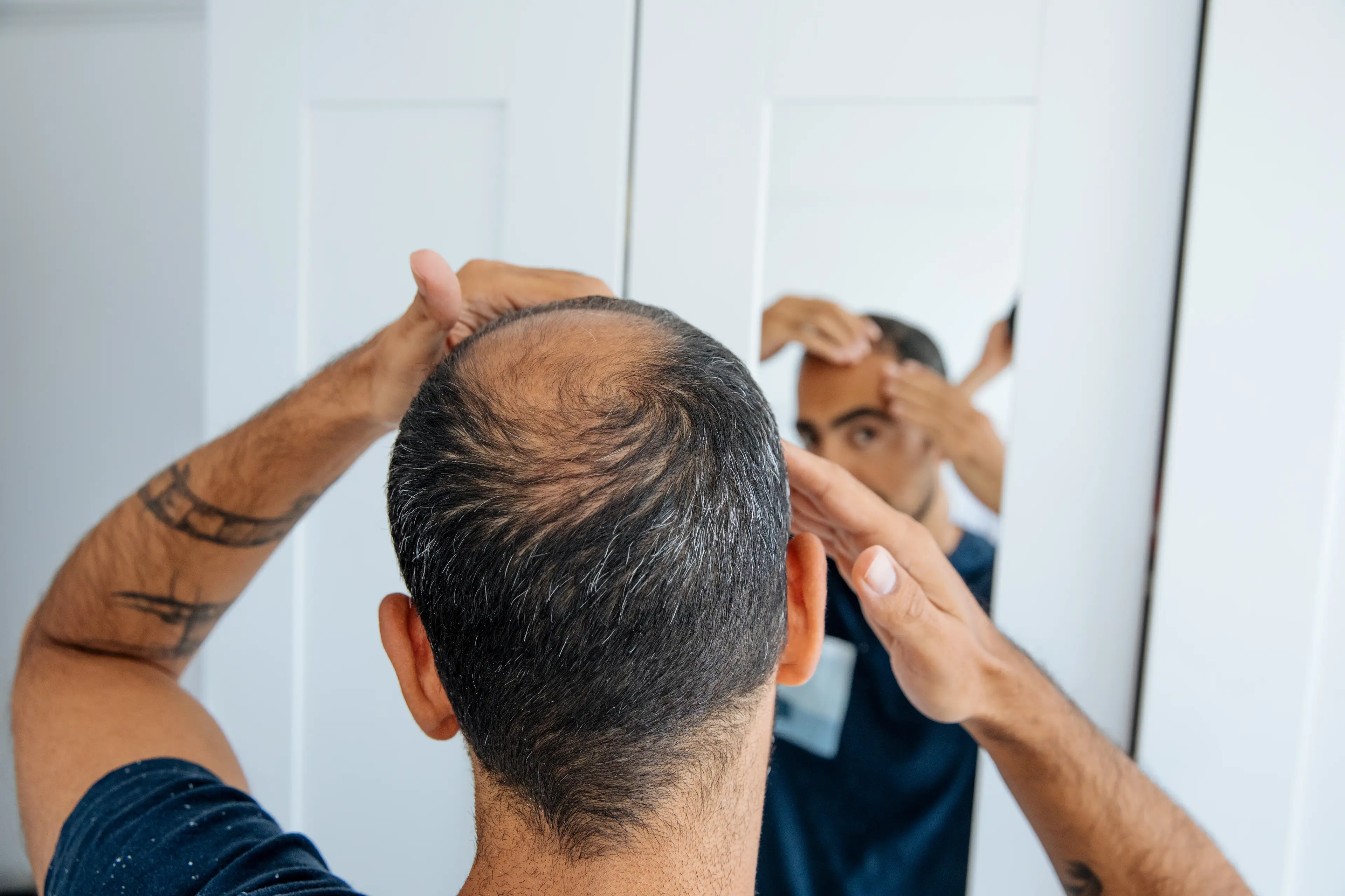 The treatment could be very helpful for baldness (agrobacter/Getty)