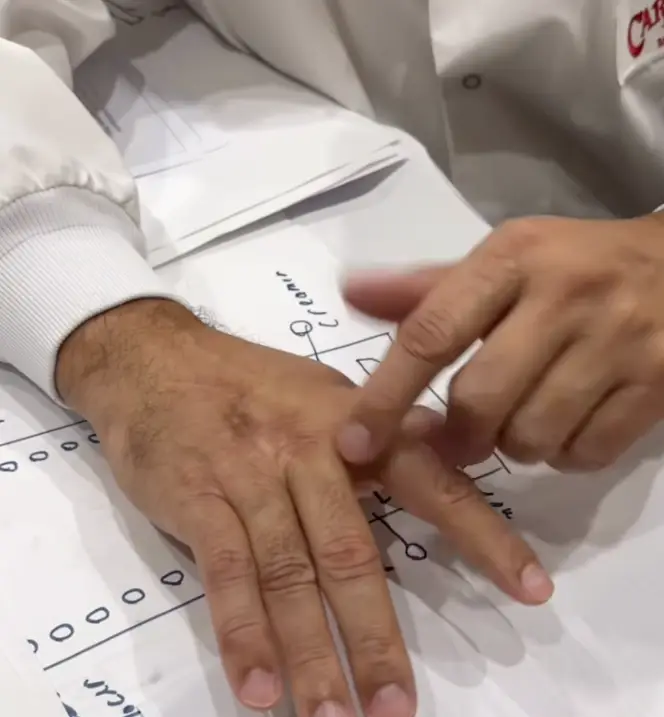 Buddy took his followers through what the surgery would entail (buddyvalastro/Instagram)