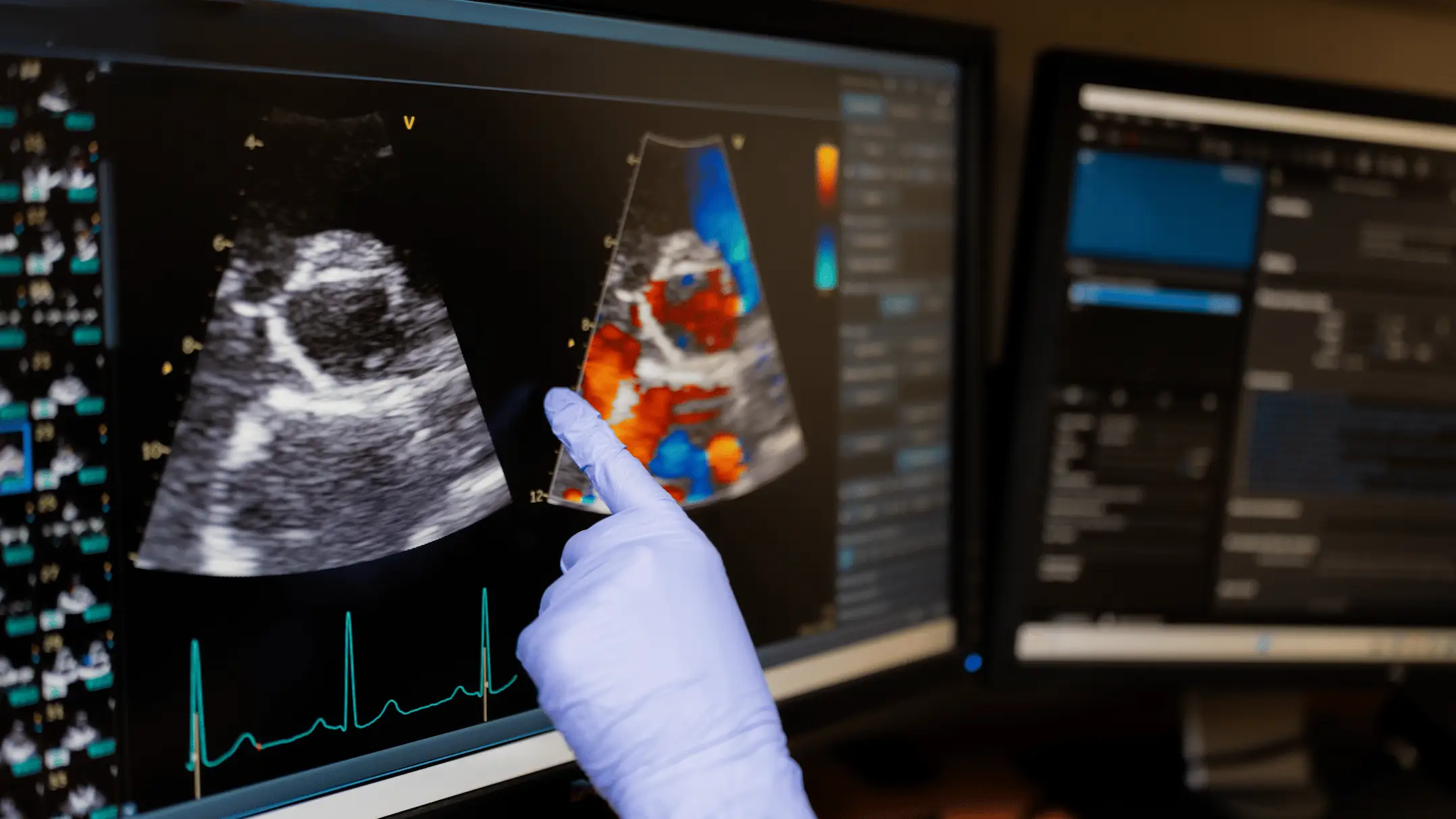 3 'damaging' foods one cardiologist would never eat